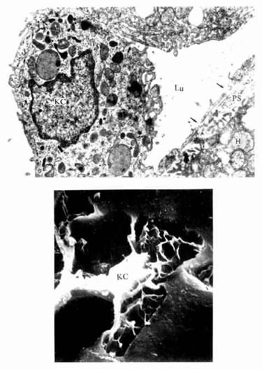  肝巨噬细胞（KC）电镜像 