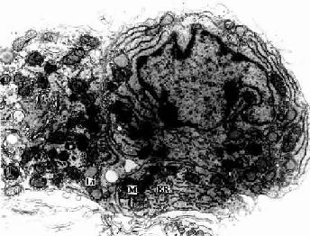 大鼠睾丸间质细胞电镜像 