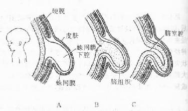  几种脑部畸形