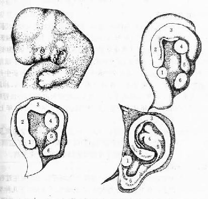 耳廓的发生 
